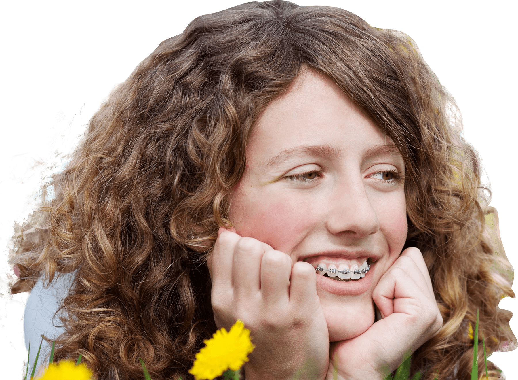 Girl wearing self ligating braces