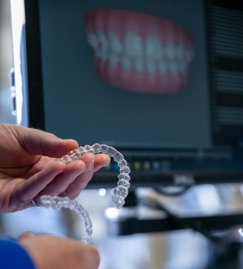 Image of Clear Aligners | Perry GA